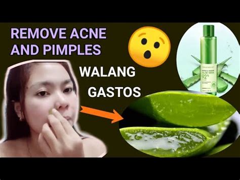 Aloe vera epektibong pantanggal ng libag .